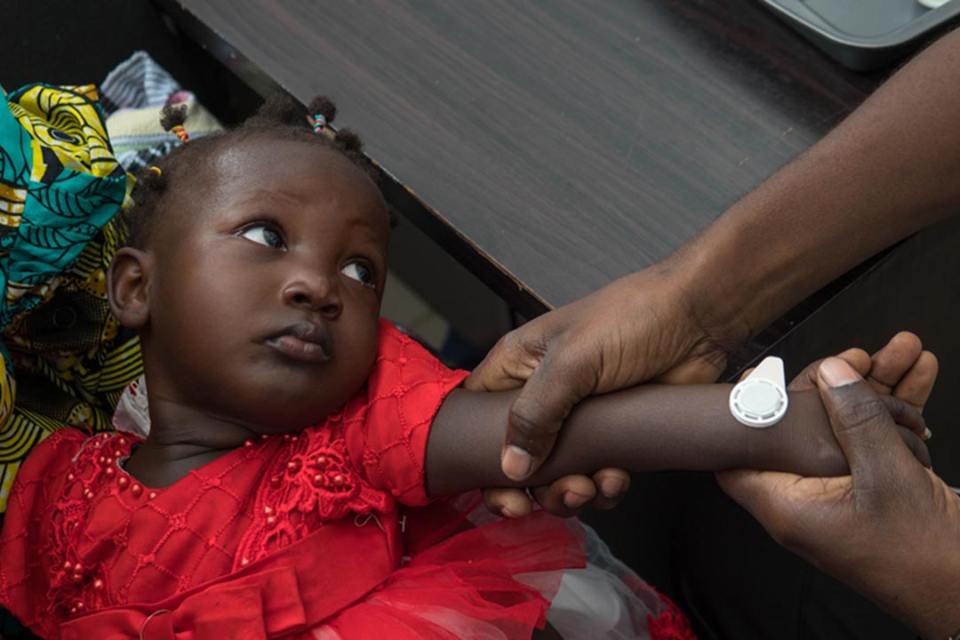 Goodbye syringe? Measles and rubella patch demonstrates its worth in Gambia vaccine trial