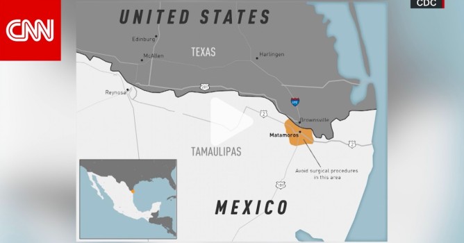 التهاب السحايا الفطري القاتل مصدره المكسيك.. ينتشر في أمريكا
