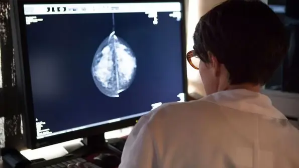 Aberdeen AI trial helps doctors spot breast cancers