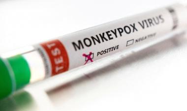 106 monkeypox cases reported in China