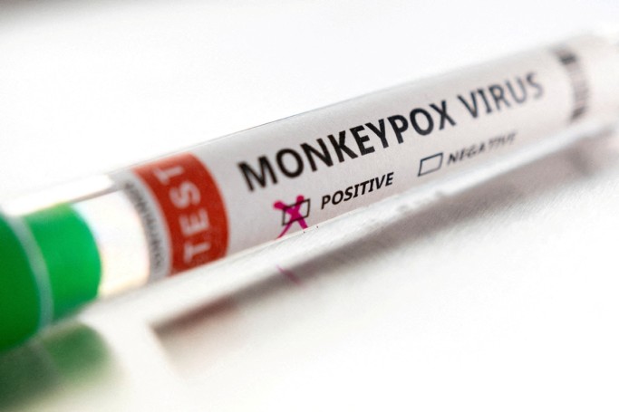 106 monkeypox cases reported in China