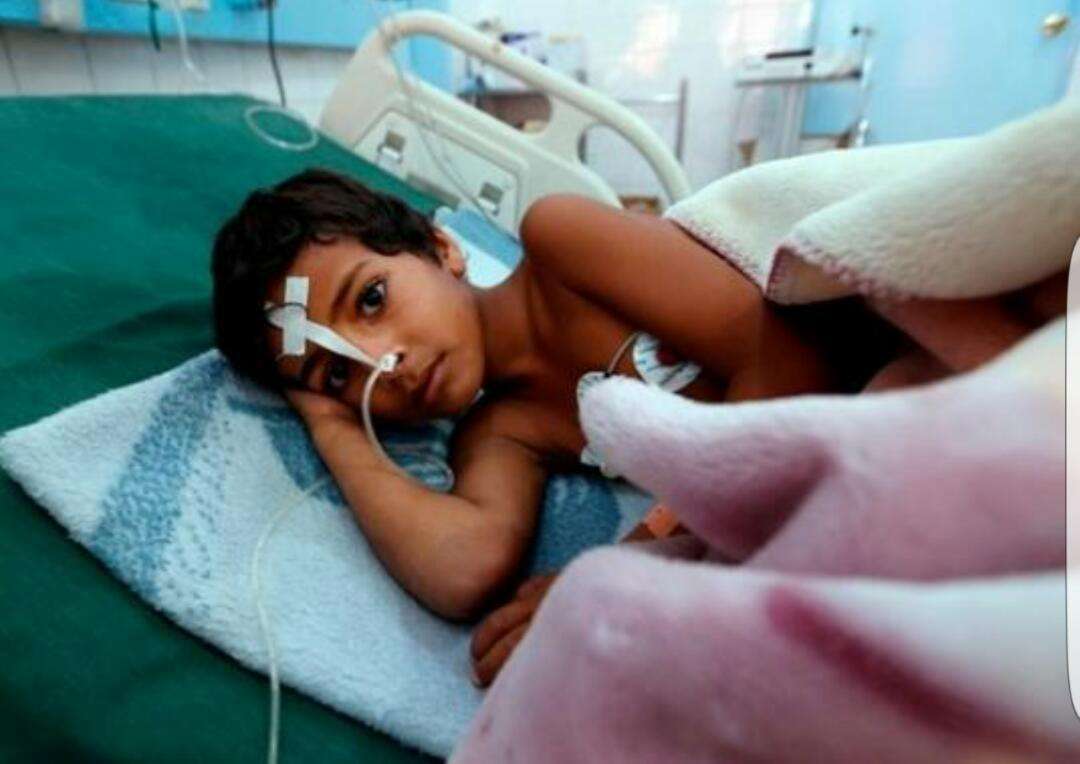 تفشي غير مسبوق للدفتيريا في اليمن 