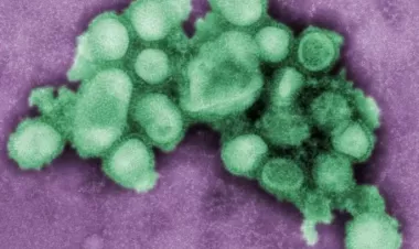 بريطانيا ترصد أول حالة بشرية مصابة بسلالة إنفلونزا مشابهة لفيروس يصيب الخنازير