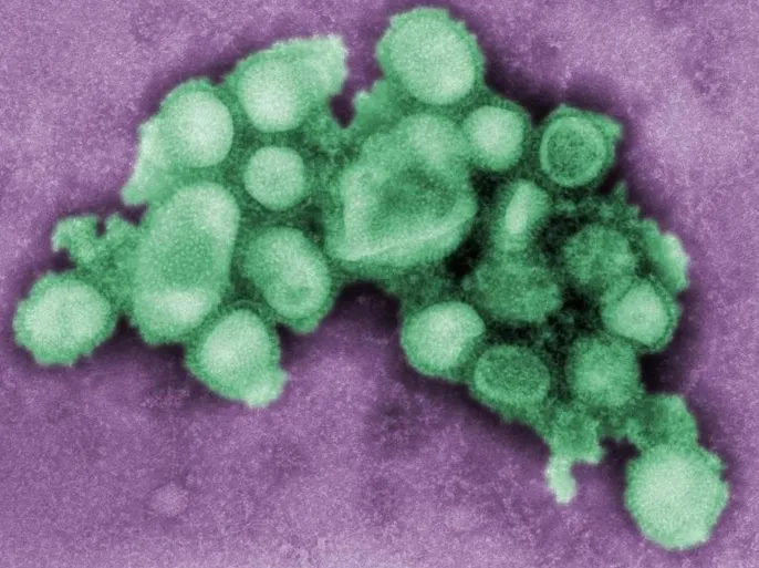 بريطانيا ترصد أول حالة بشرية مصابة بسلالة إنفلونزا مشابهة لفيروس يصيب الخنازير
