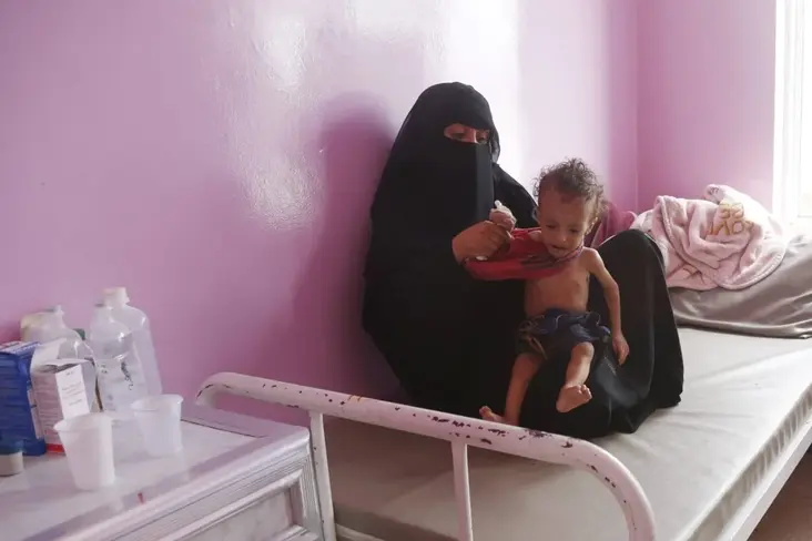 17.8m need health support in Yemen, about half of children malnourished - WHO 