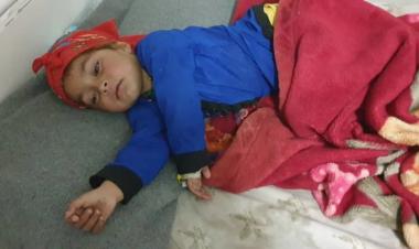 Measles Outbreak in Afghanistan: Over 7,000 Cases in Two Months, Children Most Affected