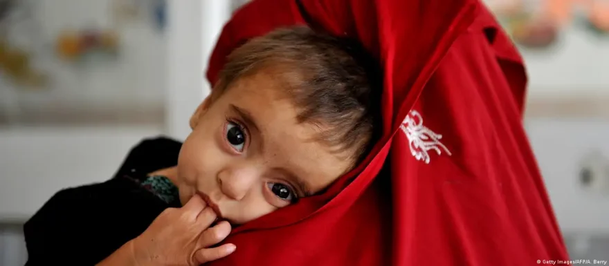 Ministry of Public Health (Afghanistan) responds to concerns of WFP: Malnutrition figures decreased