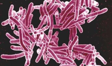 Tuberculosis bacteria also present in 90% of those with symptoms who are not diagnosed with TB, finds study