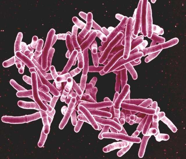 Tuberculosis bacteria also present in 90% of those with symptoms who are not diagnosed with TB, finds study