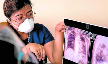 Better tuberculosis treatment set for rollout