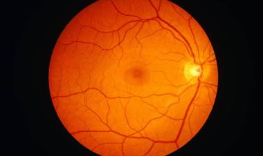 باحثون: كوفيد يخترق شبكية العين وعواقبه المحتملة خطيرة وطويلة