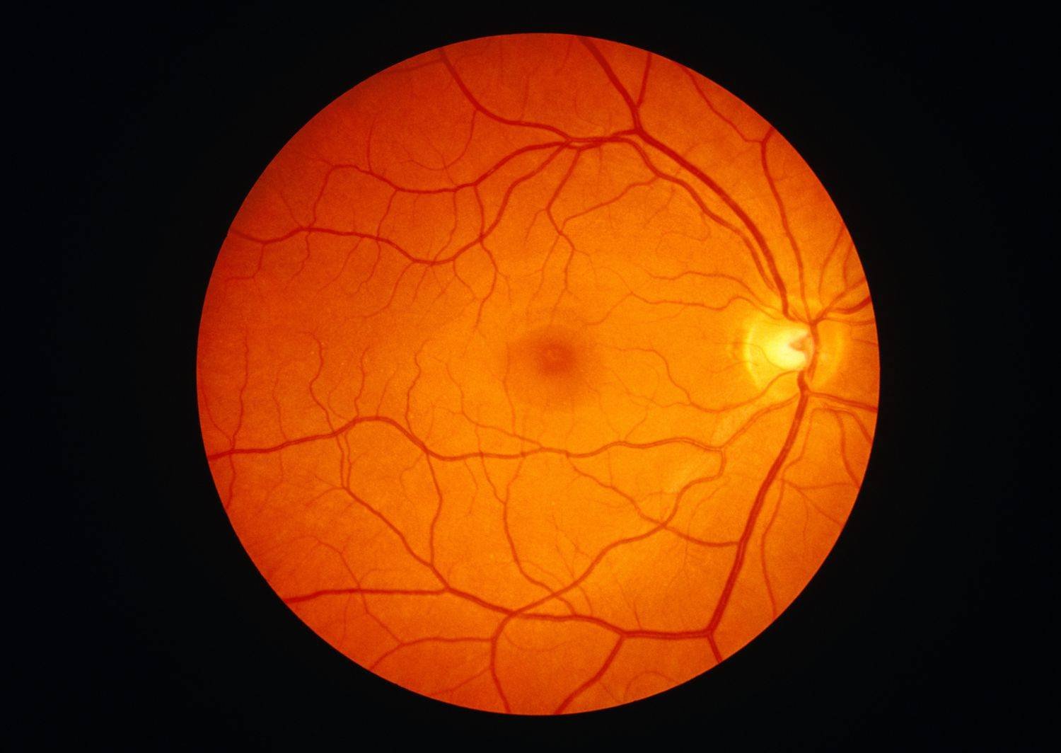 باحثون: كوفيد يخترق شبكية العين وعواقبه المحتملة خطيرة وطويلة