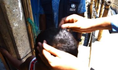 Scratching the Scalp: Addressing Head Lice in Rohingya Refugee Camps!