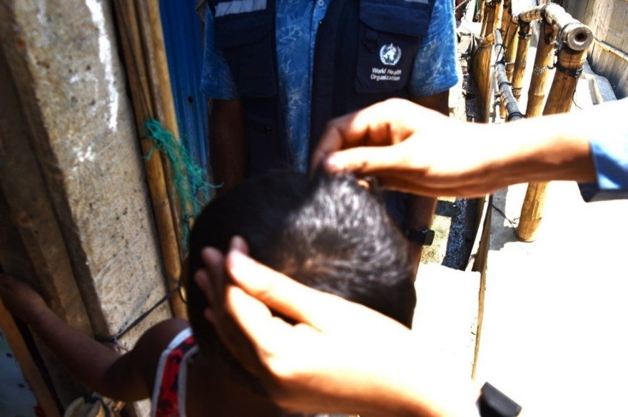 Scratching the Scalp: Addressing Head Lice in Rohingya Refugee Camps!