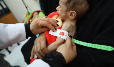 Improving nutrition is at forefront of shift from humanitarian to development action in Yemen 