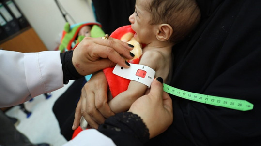 Improving nutrition is at forefront of shift from humanitarian to development action in Yemen 