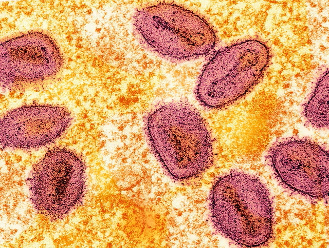 Zimbabwe reports first two mpox cases of unspecified variant