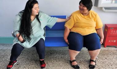 China unveils first diagnosis guidelines to battle escalating obesity crisis