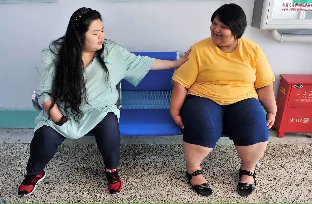 China unveils first diagnosis guidelines to battle escalating obesity crisis