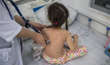 Measles cases surge worldwide, infecting 10.3 million people in 2023