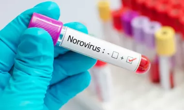 Norovirus symptoms, warning signs and when you should worry