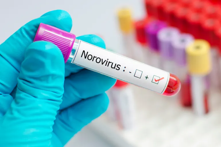 Norovirus symptoms, warning signs and when you should worry