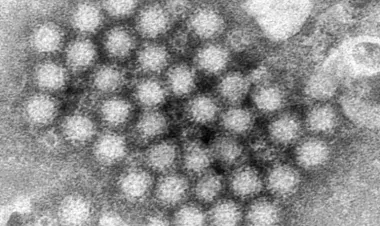 Norovirus is spiking in the US: What do we need to know?