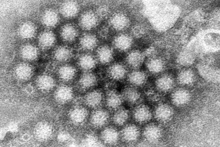 Norovirus is spiking in the US: What do we need to know?