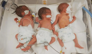 صندوق الأمم المتحدة للسكان يُحذّر من عواقب كارثية على الولادات في غزة في ظلّ المجاعة والصدمات النفسية وانهيار الرعاية الصحية