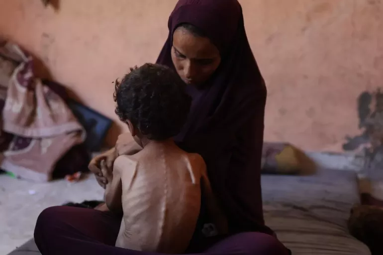 وكالات الأمم المتحدة تُحذِّر من أن المؤشرات الأساسية للغذاء والتغذية تتجاوز عتبات المجاعة في غزة