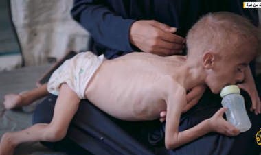 مرصد عالمي: المجاعة تتكشف في قطاع غزة