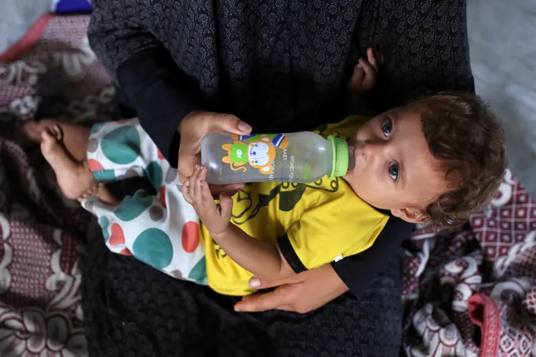 UN says every child under five in Gaza at risk of malnourishment