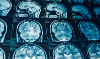 500+ Healthcare Devices in Morocco Found Exposed Online with Patient Data