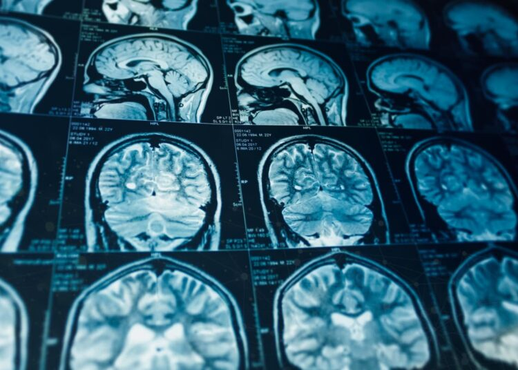 500+ Healthcare Devices in Morocco Found Exposed Online with Patient Data