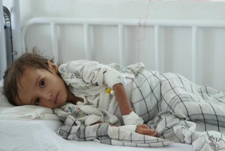 Child Malnutrition on the Rise in Afghanistan