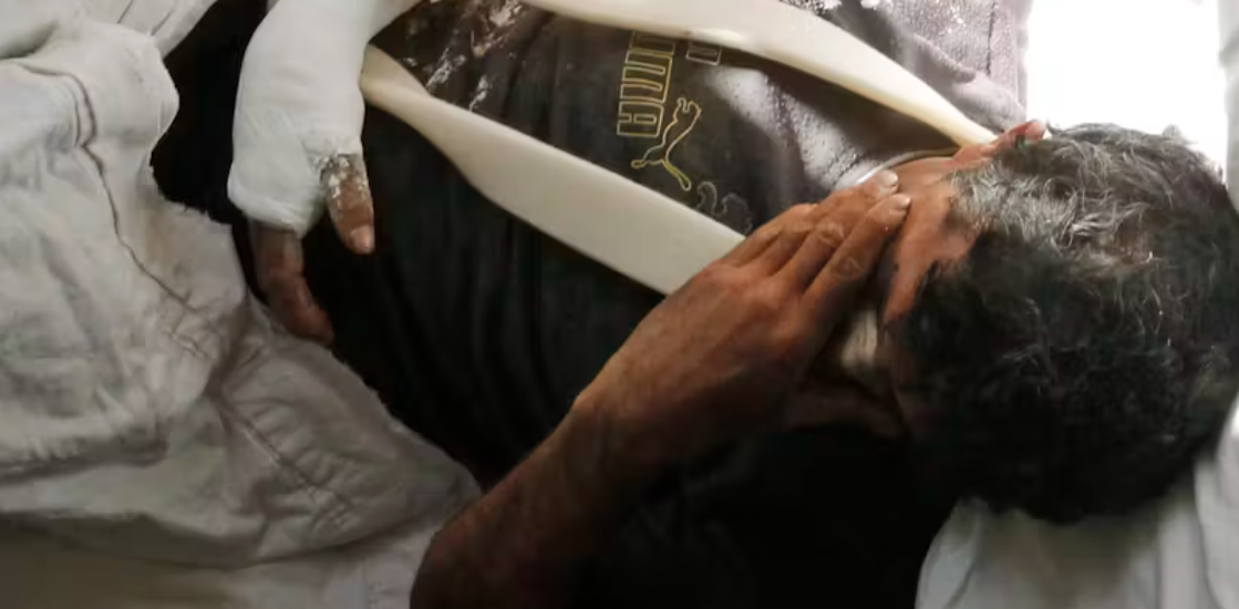 Workplace injuries: Why immigrants take longer to recover