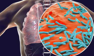 قتلت 10 ملايين.. كشف البكتيريا المسؤولة عن أول وباء في التاريخ