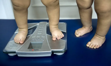 Obesity now main form of malnutrition afflicting youth: UNICEF