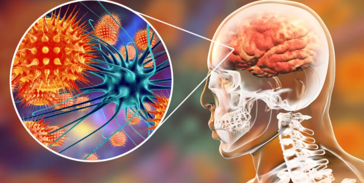 وفاة طالب جامعي بالسحايا في الطفيلة .. والصحة تفحص 46 مخالطًا