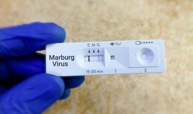 Ethiopia declares end of Marburg virus disease outbreak