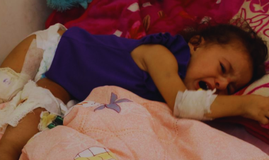 6,000 Amputees in Gaza Face Impossible Recovery amid Israeli War Ultimatum