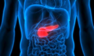 باحثون في الولايات المتحدة يطورون فحصًا دقيقًا لسرطان البنكرياس