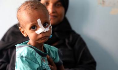 UN issues stark warning that 22 million people in Yemen at risk amid funding shortages