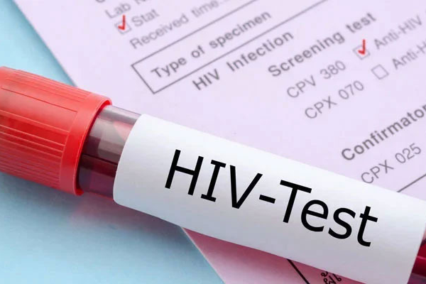 Hiding HIV numbers proving disastrous for Pakistan, health experts warn