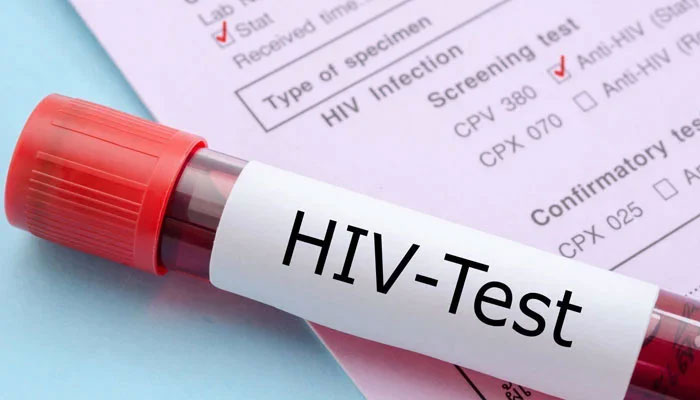 Hiding HIV numbers proving disastrous for Pakistan, health experts warn