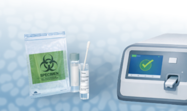 WHO and the Stop TB Partnership publish a TB near point-of-care and swab-based testing toolkit
