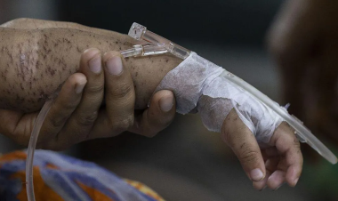Hundreds of children die within months as measles cases soar in Bangladesh