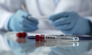 PAHO steps up preparedness across the Americas amid Ebola outbreak in Africa