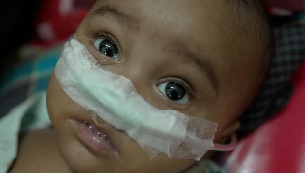 A country that made huge progress on measles now reports 120,000 cases