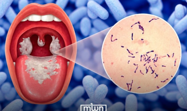 Moroccan Expert Calls for Action to Close Diphtheria Vaccination Gaps